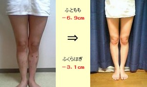 脚やせ小林・山梨.jpg