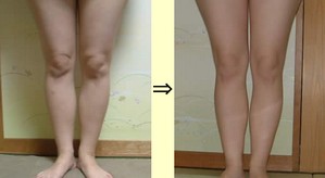 脚やせ小林・福井.jpg